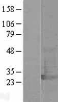 PGP9.5 (UCHL1) Human Over-expression Lysate