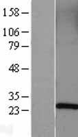 Rab5 (RAB5A) Human Over-expression Lysate