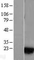 RAB1A Human Over-expression Lysate