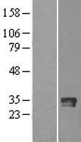 Granzyme B (GZMB) Human Over-expression Lysate