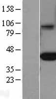FCGRT Human Over-expression Lysate
