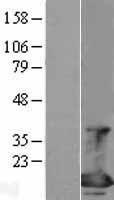EIF4EBP1 Human Over-expression Lysate