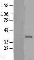 Cathepsin S (CTSS) Human Over-expression Lysate