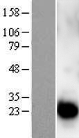 Centrin 1 (CETN1) Human Over-expression Lysate