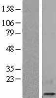 beta 2 Microglobulin (B2M) Human Over-expression Lysate
