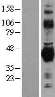 CD32B (FCGR2B) Human Over-expression Lysate