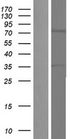 TNK1 Human Over-expression Lysate