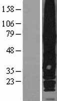 RAI3 (GPRC5A) Human Over-expression Lysate