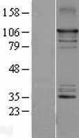 NFkB Inducing Kinase NIK (MAP3K14) Human Over-expression Lysate