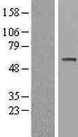 P70 S6 Kinase beta (RPS6KB2) Human Over-expression Lysate