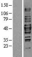 HDAC3 Human Over-expression Lysate