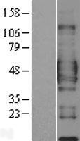 CD84 Human Over-expression Lysate