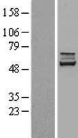 CES2 Human Over-expression Lysate