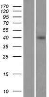 ST2 (IL1RL1) Human Over-expression Lysate