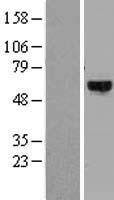 DYRK4 Human Over-expression Lysate
