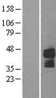 DR5 (TNFRSF10B) Human Over-expression Lysate