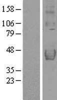 DcR2 (TNFRSF10D) Human Over-expression Lysate