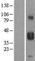 DLK (DLK1) Human Over-expression Lysate