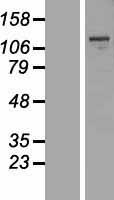 S1P (MBTPS1) Human Over-expression Lysate