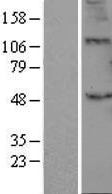 B3GALT2 Human Over-expression Lysate