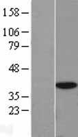 EIF3S2 (EIF3I) Human Over-expression Lysate