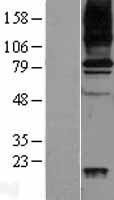 VAP1 (AOC3) Human Over-expression Lysate