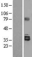 Stanniocalcin 2 (STC2) Human Over-expression Lysate