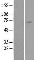 SLC25A12 Human Over-expression Lysate