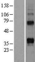 RANKL (TNFSF11) Human Over-expression Lysate