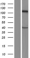 CASK Human Over-expression Lysate