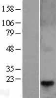 Telethonin (TCAP) Human Over-expression Lysate