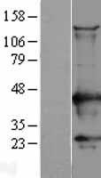 CaMKI (CAMK1) Human Over-expression Lysate
