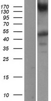 IKK gamma (IKBKG) Human Over-expression Lysate