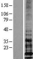 IFITM1 Human Over-expression Lysate