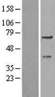 PEX3 Human Over-expression Lysate