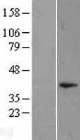 DUSP11 Human Over-expression Lysate