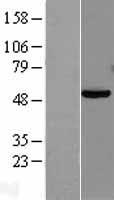 PAX8 Human Over-expression Lysate