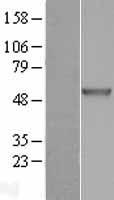 CHIT1 Human Over-expression Lysate