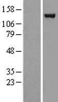 USP7 Human Over-expression Lysate