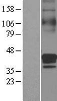 SLC30A3 Human Over-expression Lysate