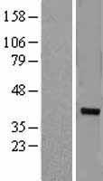 ZNF177 Human Over-expression Lysate