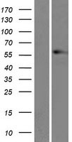 Vimentin (VIM) Human Over-expression Lysate