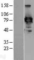 Ezrin (EZR) Human Over-expression Lysate