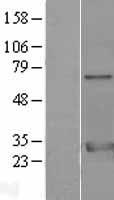 14-3-3 zeta (YWHAZ) Human Over-expression Lysate