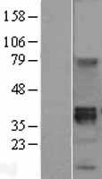 WNT8B Human Over-expression Lysate