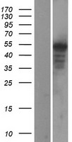 WNT5A Human Over-expression Lysate