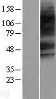 VPAC2 (VIPR2) Human Over-expression Lysate