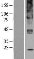 Ceramide glucosyltransferase (UGCG) Human Over-expression Lysate