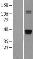 TTF1 (NKX2-1) Human Over-expression Lysate