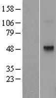 TRH Receptor (TRHR) Human Over-expression Lysate